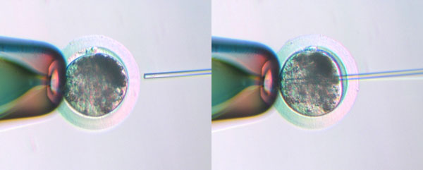 Intracytoplasmic Sperm Injection Intracytoplasmic Sperm Injection