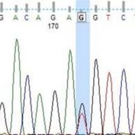 Sequencing Sequencing