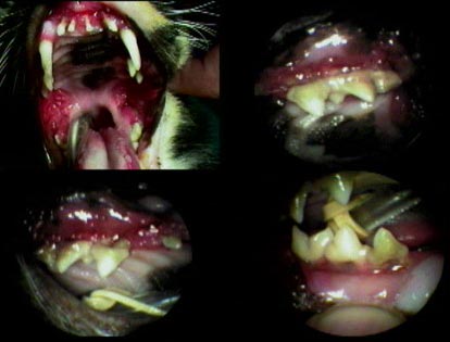 Severe LPS in a 3 year old