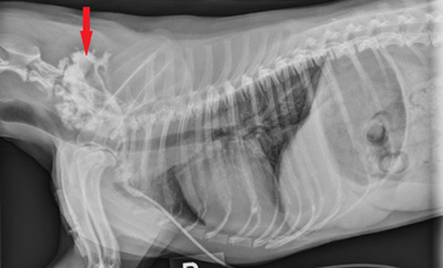 Stenotic Ear Canal