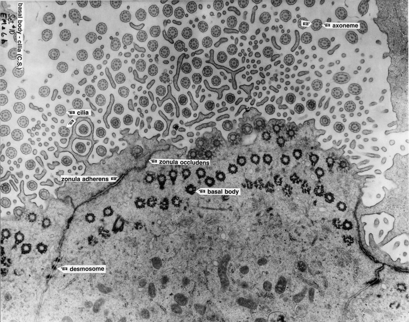 Ciliated Cells 6b