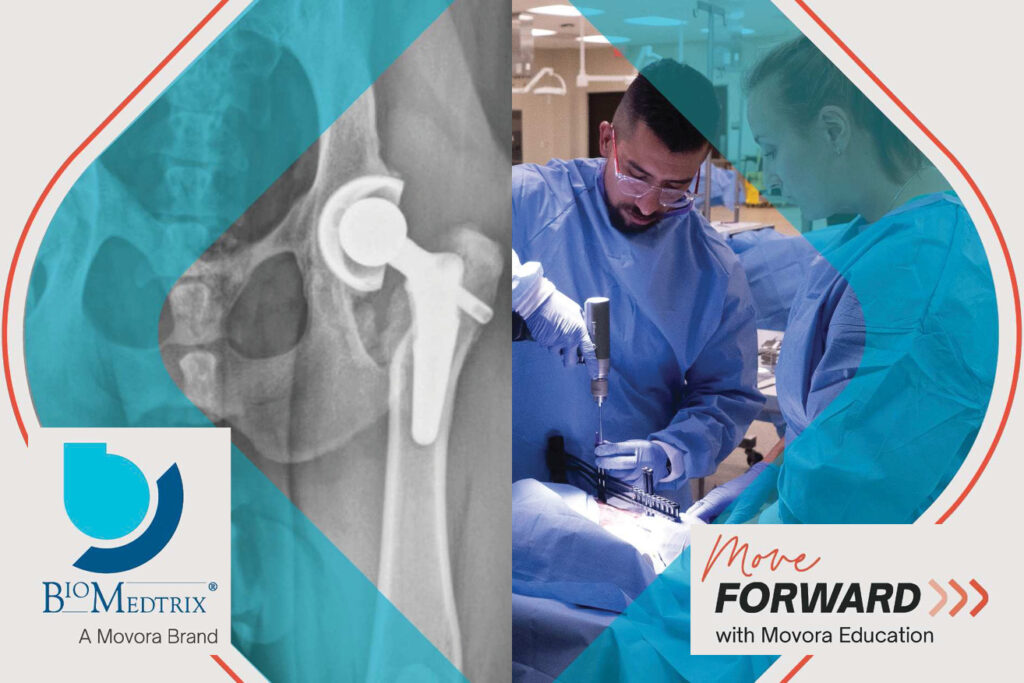a digital x-ray showing a universal hip joint and a male and female during surgery implanting an i-loc im fixator with logos from  biomedtrix and move forward with movora education