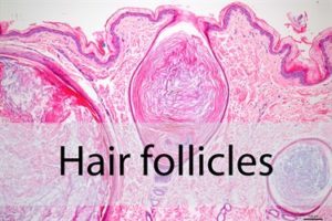 Hair Follicles