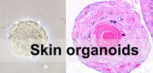 A picture of Skin Organoids