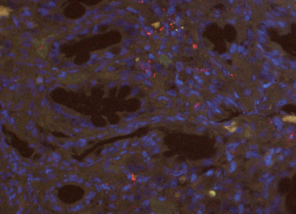 Colon from a dog with red-staining invasive E. coli causing granulomatous colitis. Fluorescence image using fluorescent in-situ hybridization (FISH).