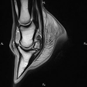 3T MRI of a horse foot