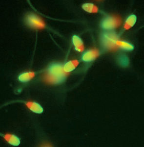 glowing sperm under microscope