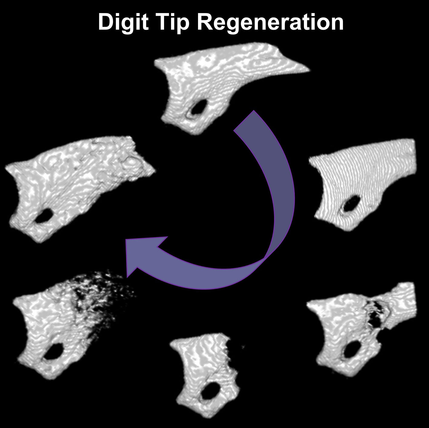 Graphic of finger digit bone regrowing