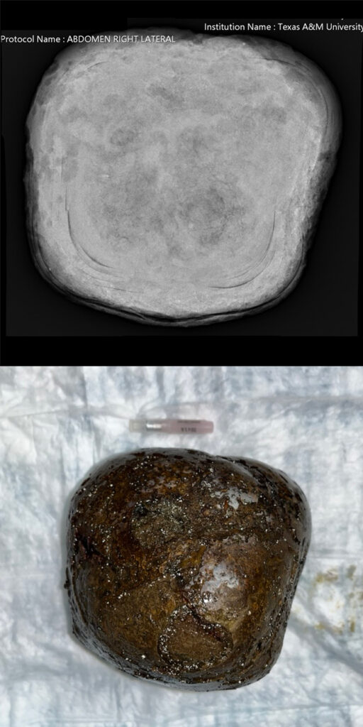 X-ray of a large roundish stone, then a photo of the stone