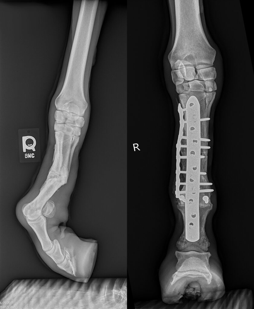 Side by side radiographs of Jeffery's broken leg and the same leg once fixed with implants