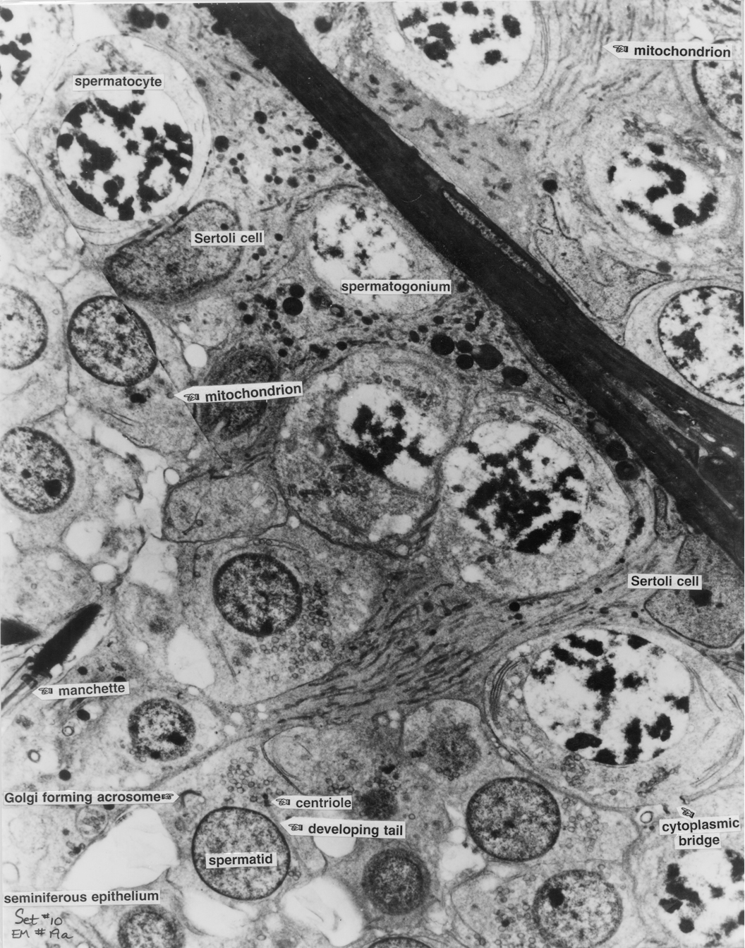 Testis 19a