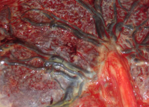Maternal-fetal vasculature